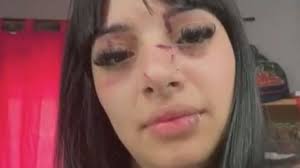 "Sos la de TikTok": atacan a una mujer "por linda" al salir de una discoteca.